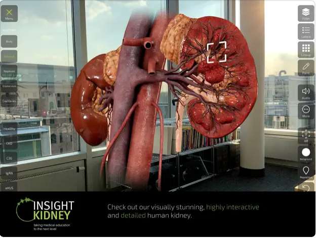 [Appstore Playstore] Insight Kidney (Nieren / Nephrologie) / grafische Info-App Medizin