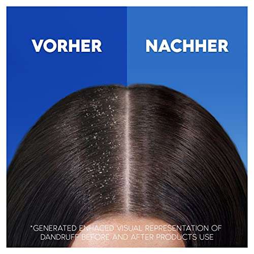 (Prime Spar-Abo) Head & Shoulders Empfindliche Kopfhaut Anti-Schuppen Shampoo, Bis Zu 100% Schuppenschutz, 300ml
